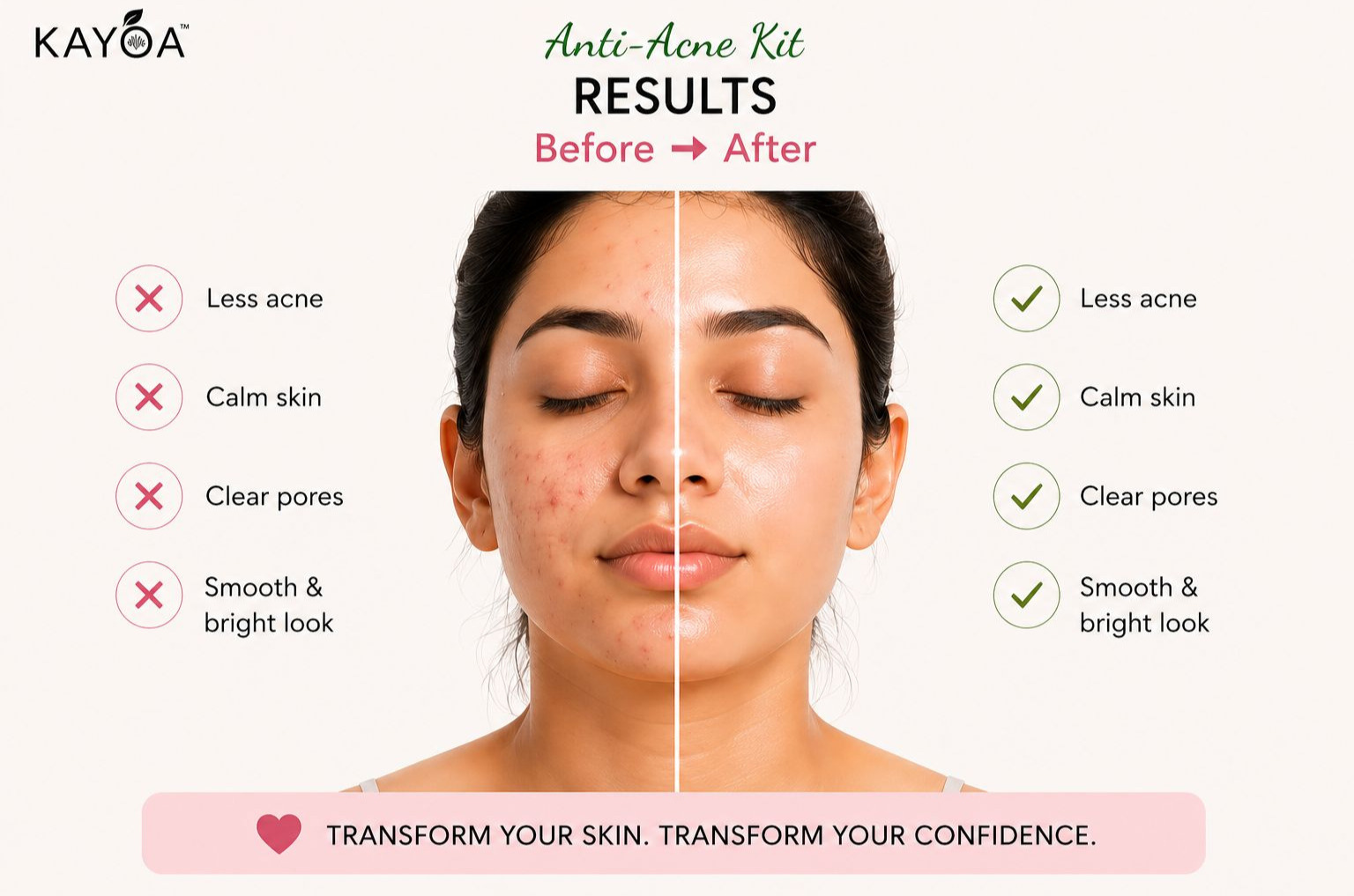 Kayoa Anti Acne Kit - Image 5